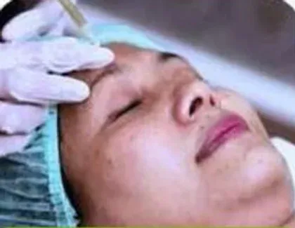 Injectables & Skin Boosters